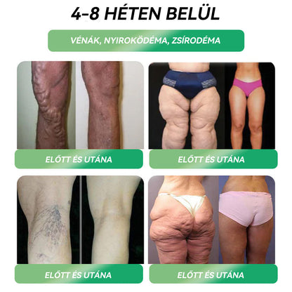 𝐇𝐢𝐯𝐚𝐭𝐚𝐥𝐨𝐬 Á𝐫𝐮𝐡á𝐳 | 𝐏𝐮𝐧𝐠𝐚𝐫𝐲™ 𝑮𝐿𝘗-𝟭 𝐅𝐨𝐠𝐲𝐚𝐬𝐳𝐭ó 𝐒𝐳á𝐣𝐨𝐧 á𝐭 𝐛𝐞𝐯𝐞𝐡𝐞𝐭ő 𝐨𝐥𝐝𝐚𝐭 – 𝐓á𝐦𝐨𝐠𝐚𝐭𝐣𝐚 𝐚𝐳 𝐞𝐥𝐡í𝐳á𝐬, 𝐚 𝐬𝐳í𝐯- é𝐬 é𝐫𝐫𝐞𝐧𝐝𝐬𝐳𝐞𝐫𝐢 𝐛𝐞𝐭𝐞𝐠𝐬é𝐠𝐞𝐤, 𝐚 𝐜𝐮𝐤𝐨𝐫𝐛𝐞𝐭𝐞𝐠𝐬é𝐠, 𝐚𝐳 𝐚𝐥𝐯á𝐬𝐢 𝐚𝐩𝐧𝐨𝐞, 𝐚𝐳 í𝐳ü𝐥𝐞𝐭𝐢 𝐩𝐫𝐨𝐛𝐥é𝐦á𝐤 é𝐬 𝐦é𝐠 𝐬𝐨𝐤 𝐦á𝐬 𝐤𝐞𝐳𝐞𝐥é𝐬é𝐭